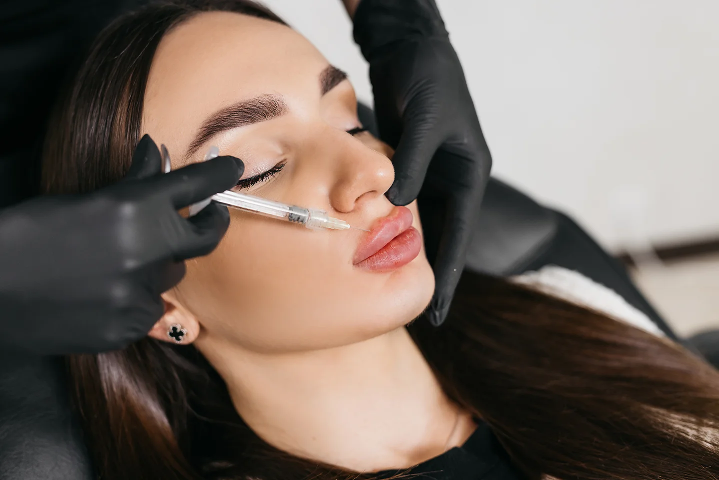 Is 2 Syringes of Lip Filler Right for You?