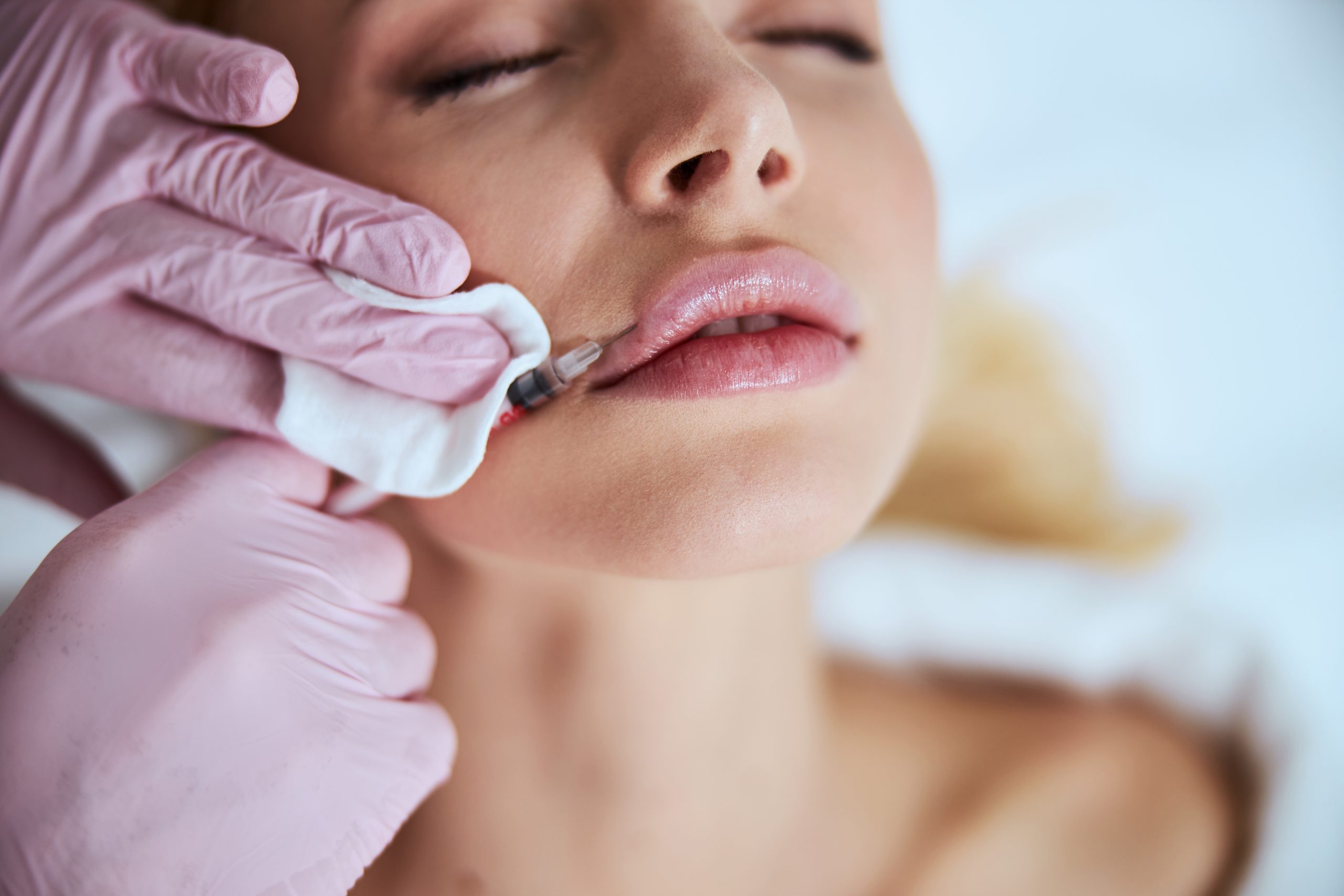 Gloved hands guiding a fine needle into the corner of a woman’s lips while she rests with her eyes closed