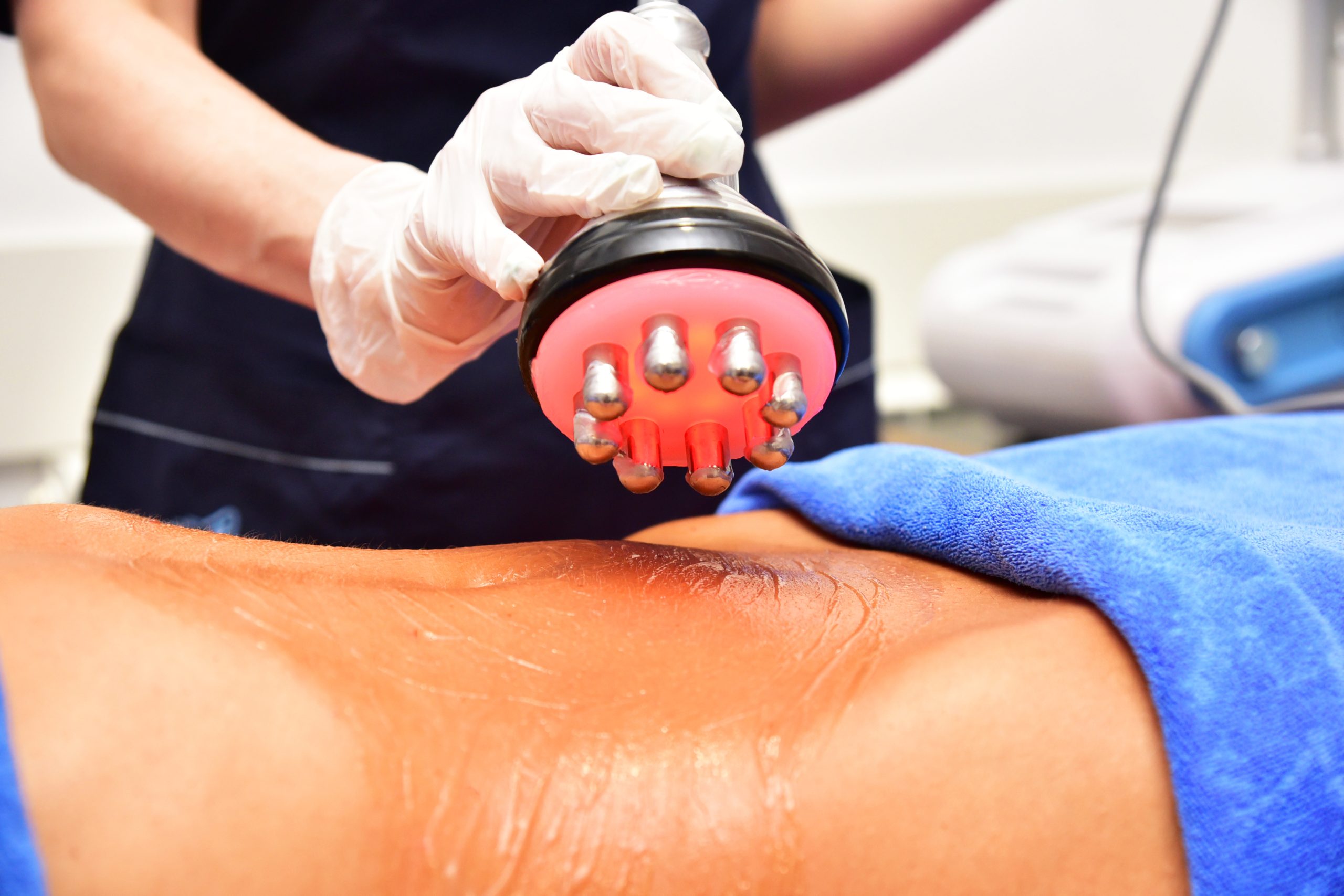 Venus Legacy Treatment: Harnessing the Power of Technology for Body Contouring and Skin Tightening