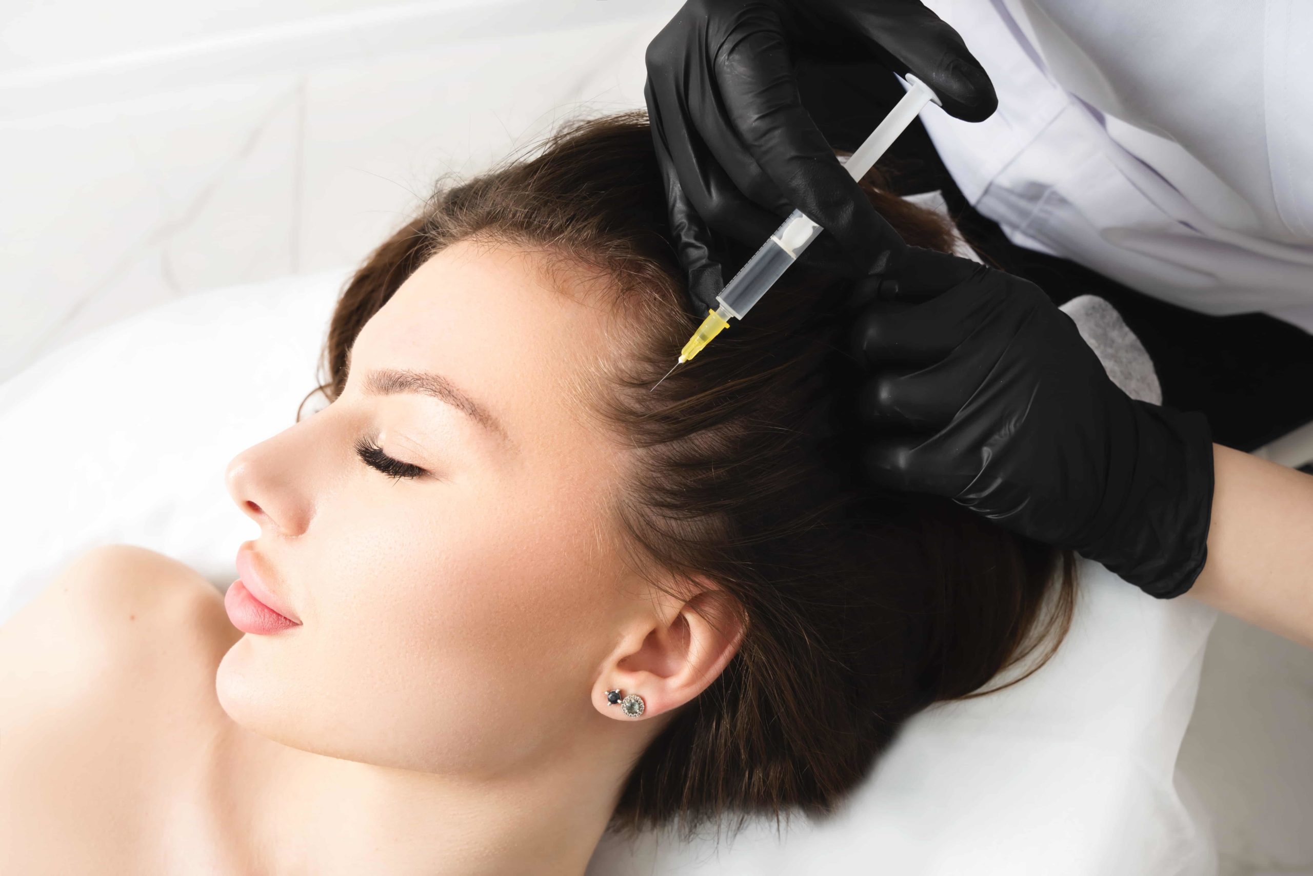 What is the best method for PRP Hair Restoration?