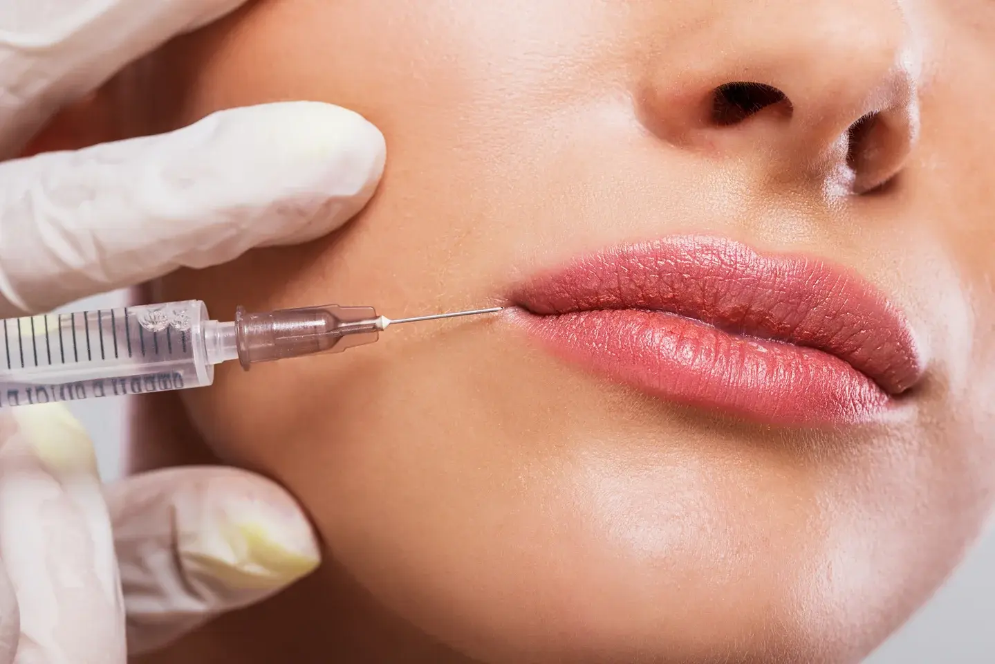 How to Inject Lip Fillers: Achieving Subtle and Stunning Results