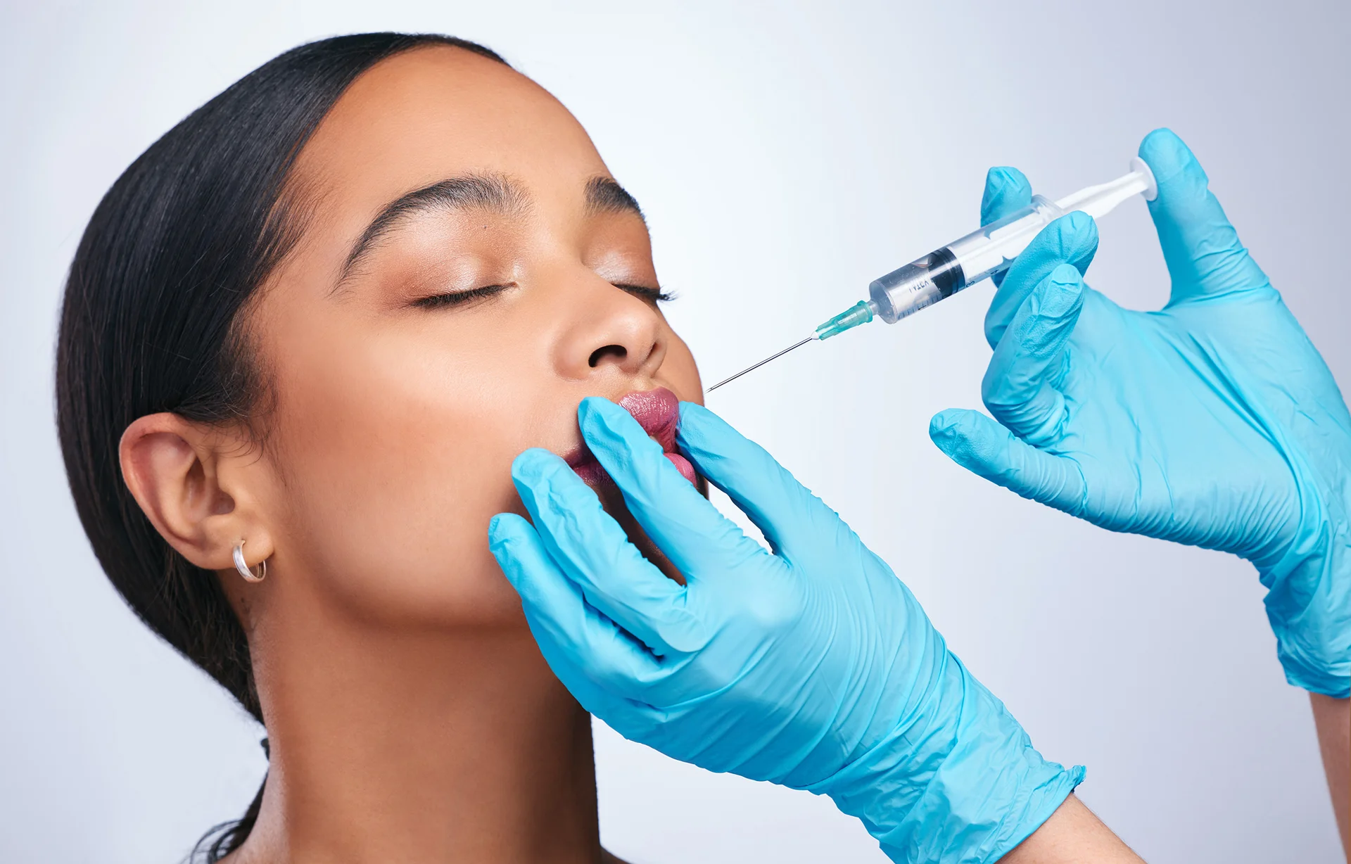 Lip Filler Cannula: The Innovative Technique for Natural-Looking Lip Enhancement