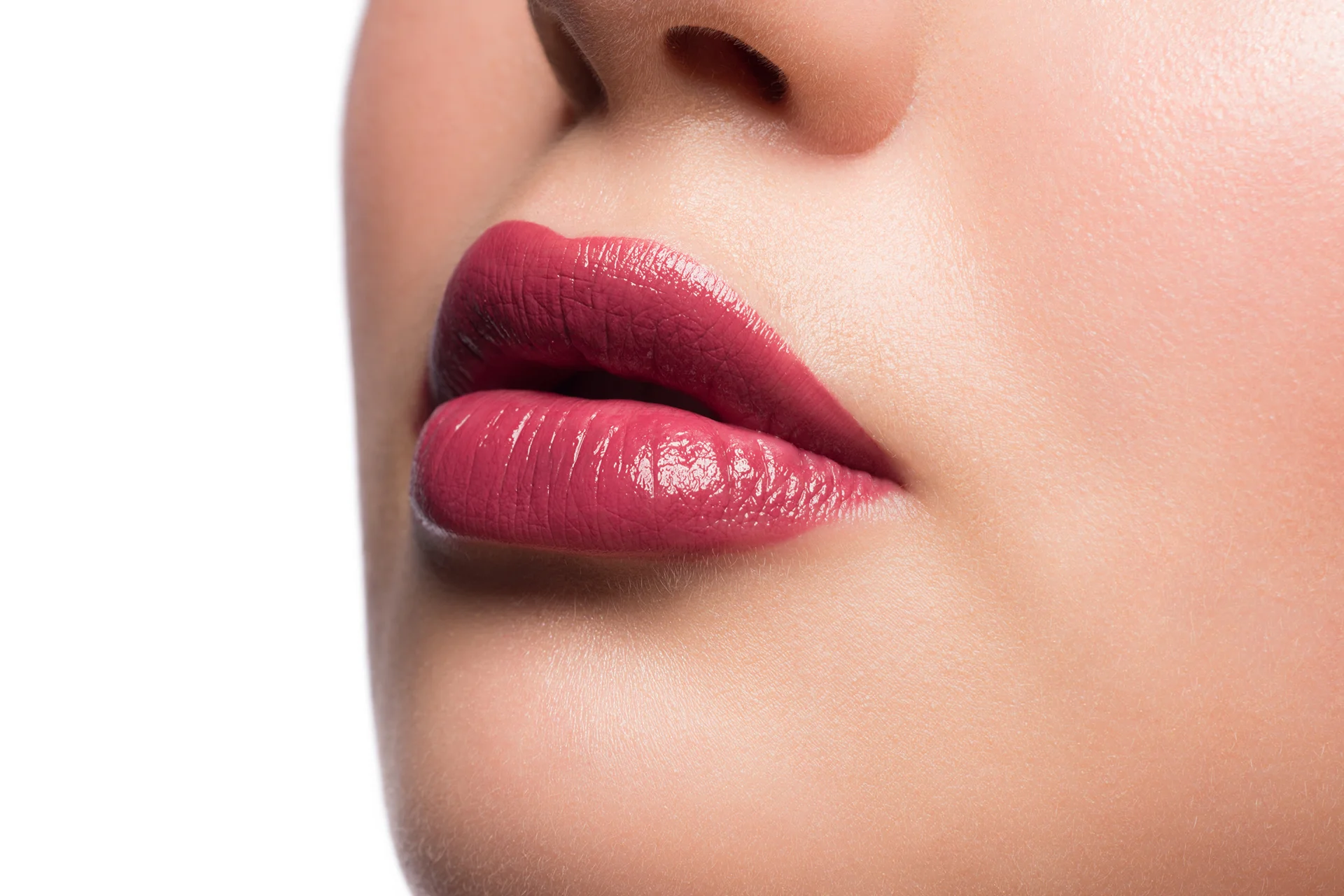 Lip Filler Migration: Causes, Symptoms, and Solutions