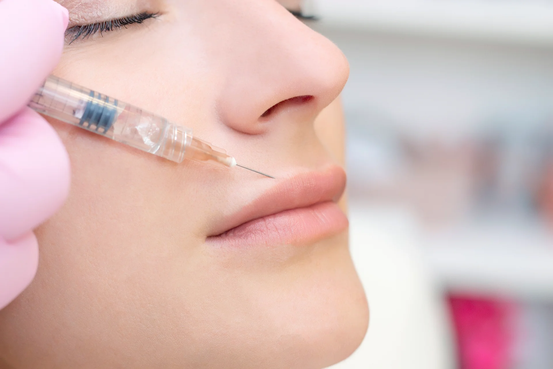 Lip Filler on Small Mouth: Expert Tips for Naturally Plump Lips