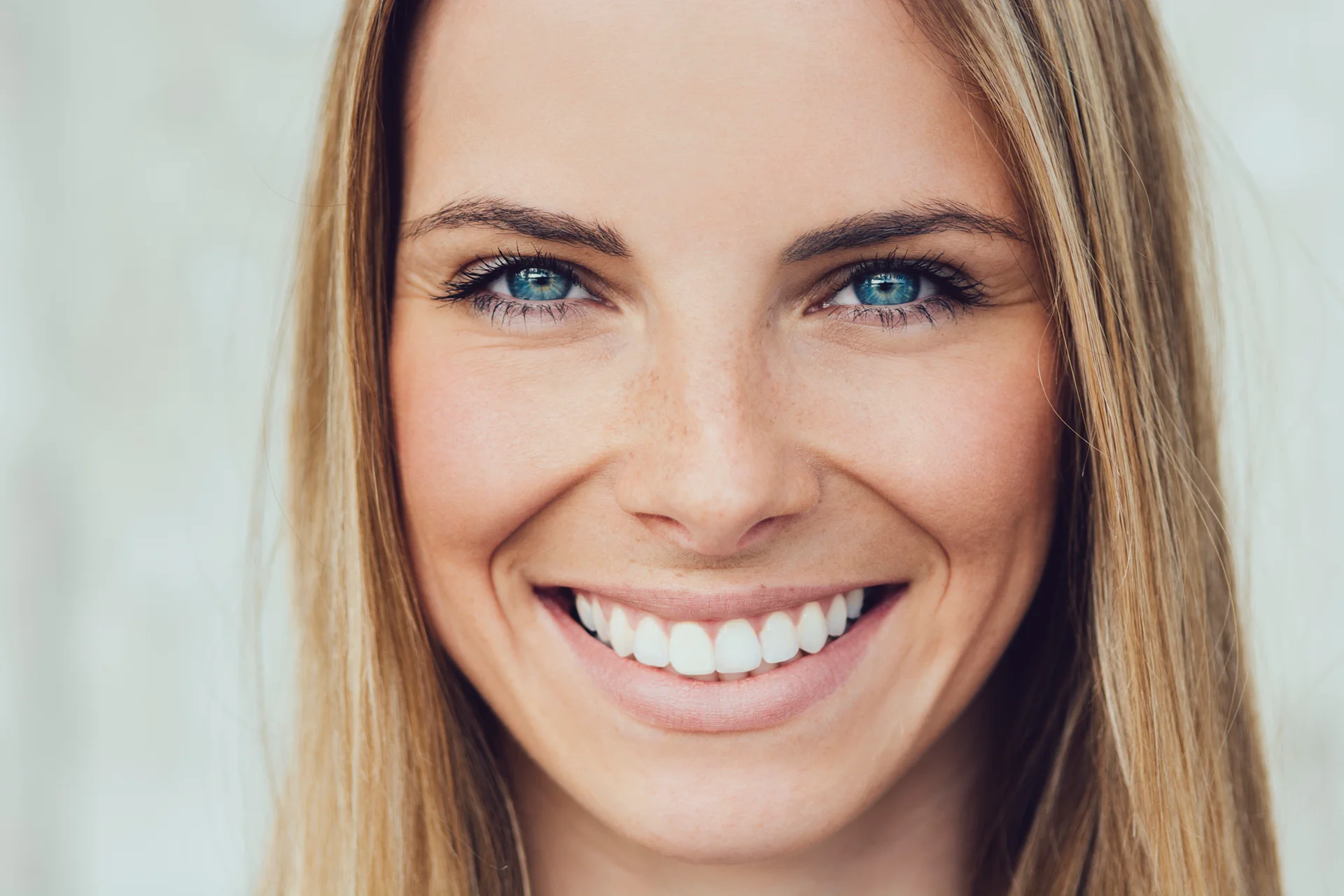 Lip Fillers for Gummy Smile