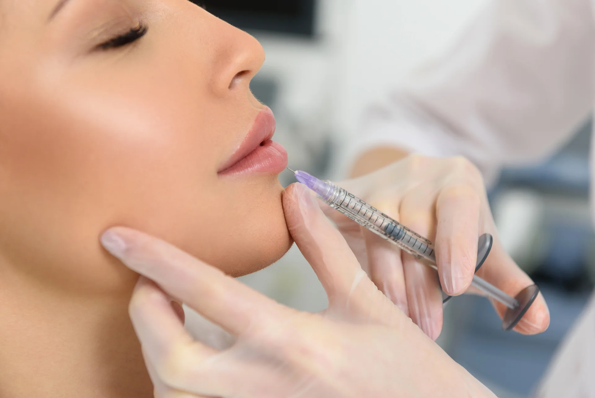 Lip Shape Lip Fillers: An Expert Guide to Enhancing Your Pout