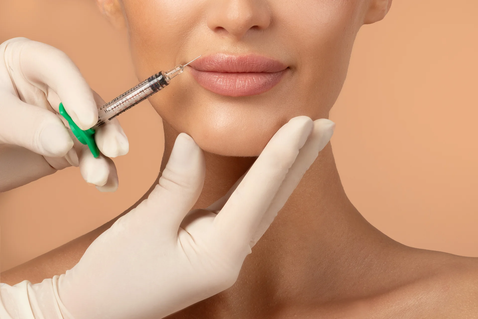 Russian Lip Filler Technique Vs Normal