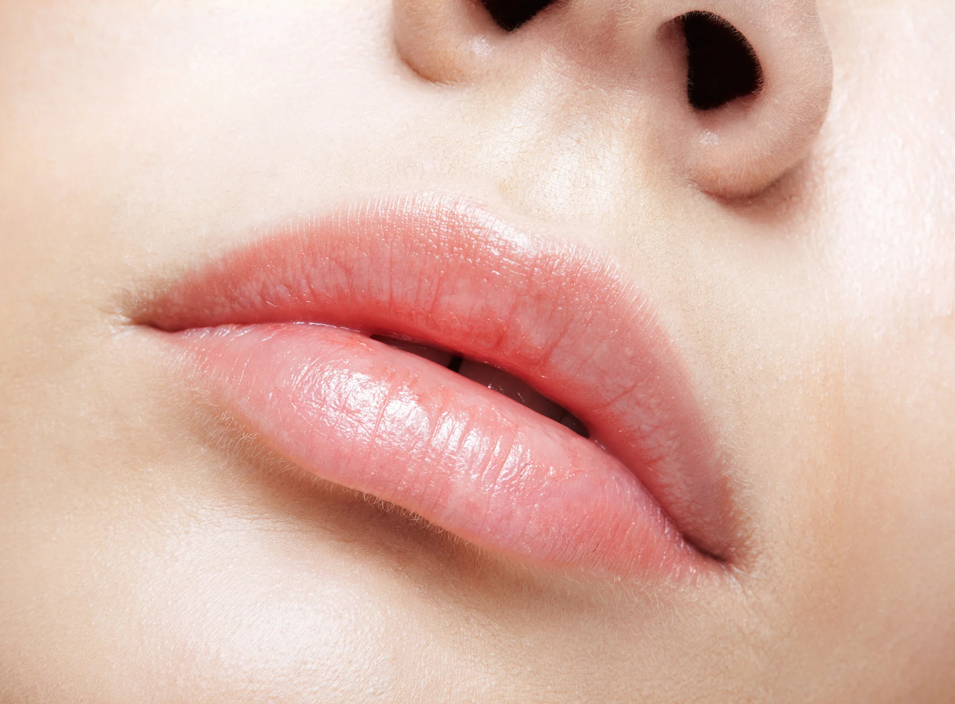 a portrait of a woman with plump lips|a woman applies lip balm on her lips|a woman receives lip filler injections