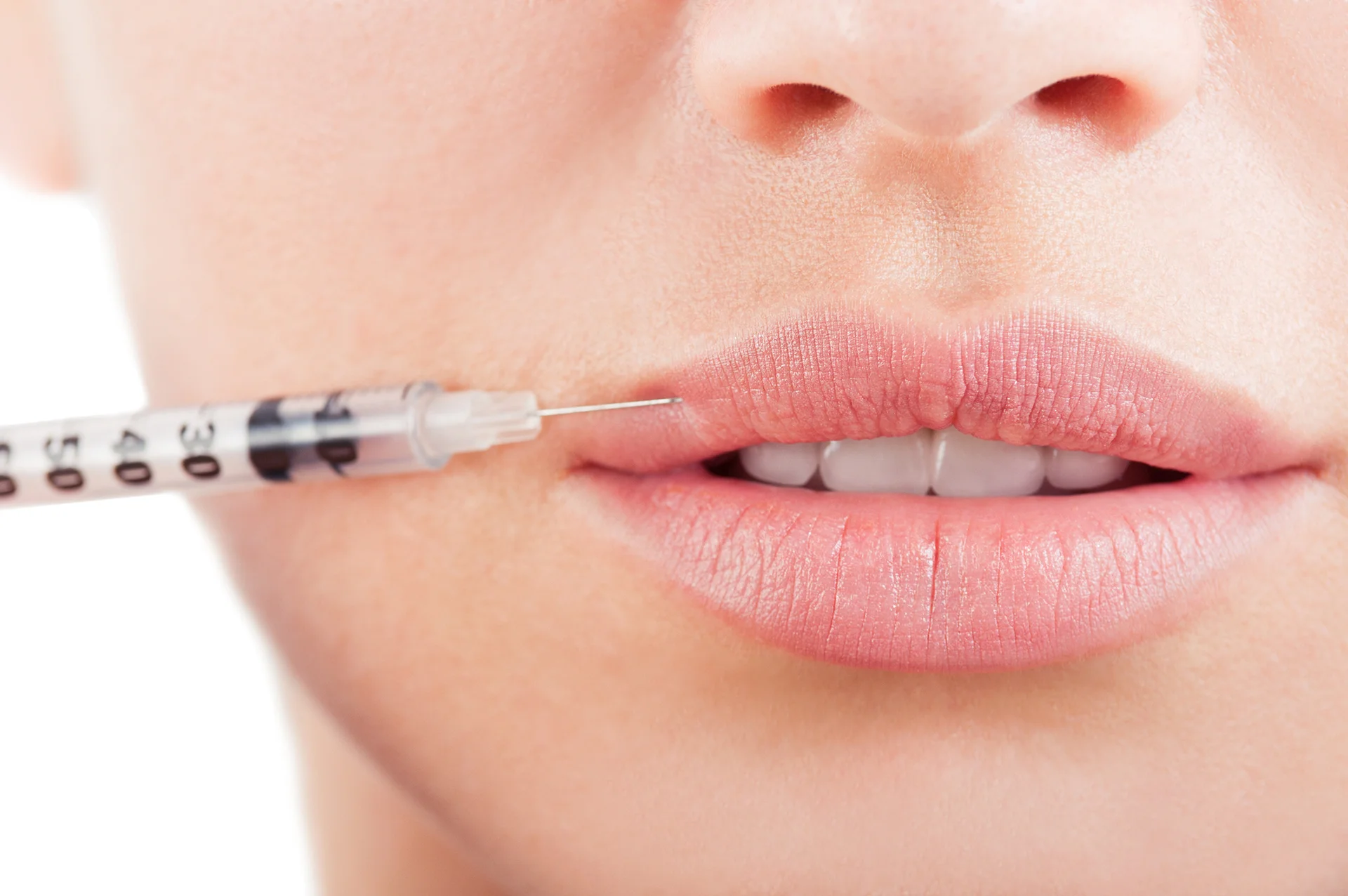 lip filler procedure|a woman applies lip gloss on her lips|a portrait of a relaxed woman