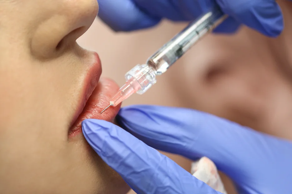 lip injector injects lip filler on a patient
