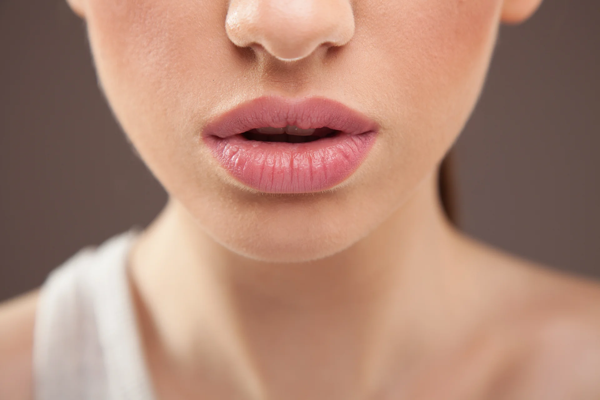 when can you kiss after lip fillers