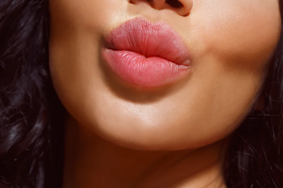 lip shape lip fillers