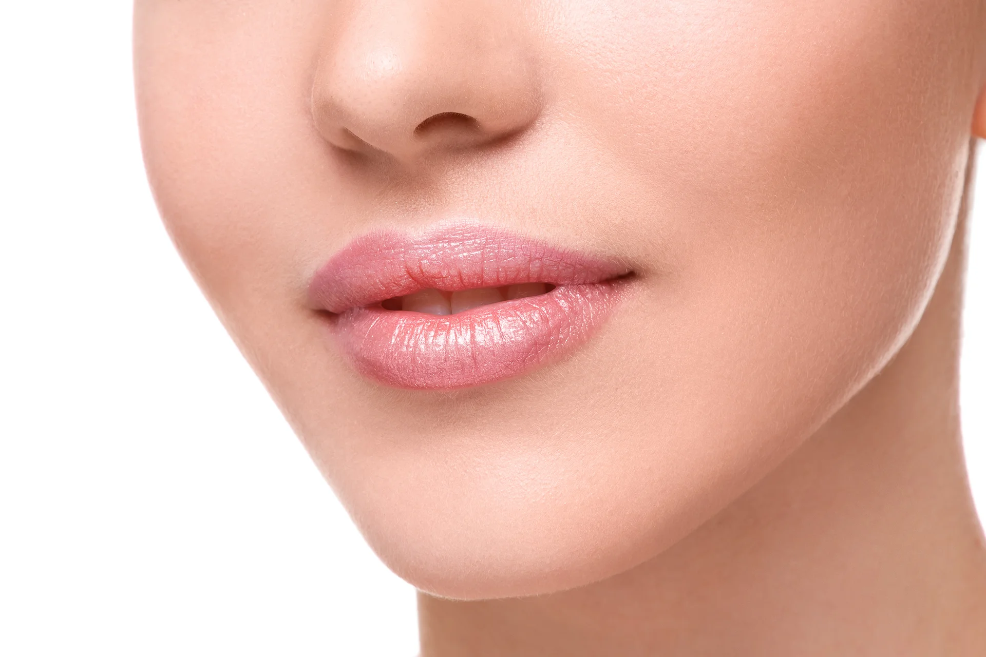 corner lip lift with filler