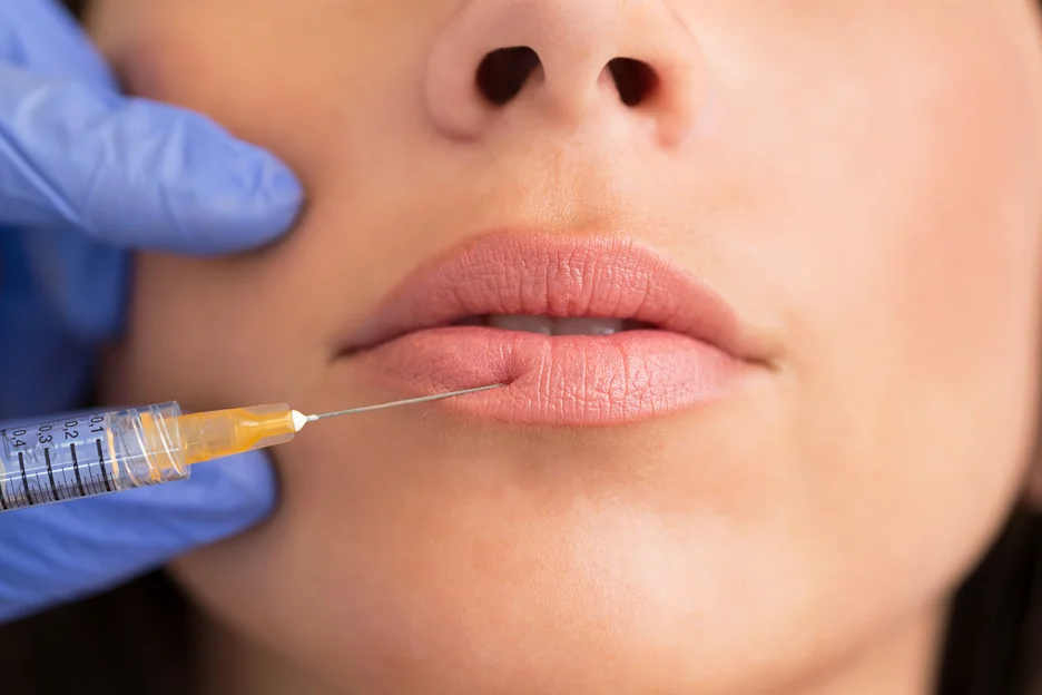 a woman recieved lip filler injections after aesthetician applied numbing cream