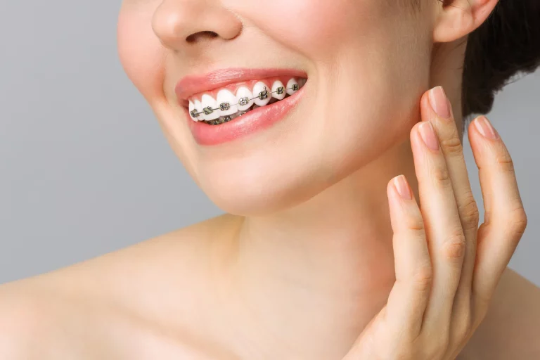 a portrait of a woman with braces smiling after lip filler treatment