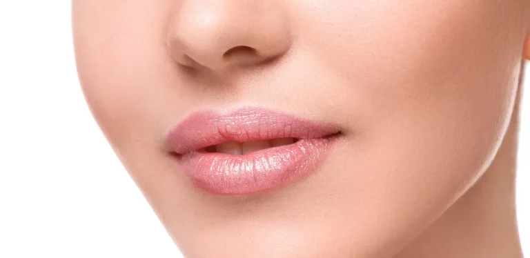 lip filler botox