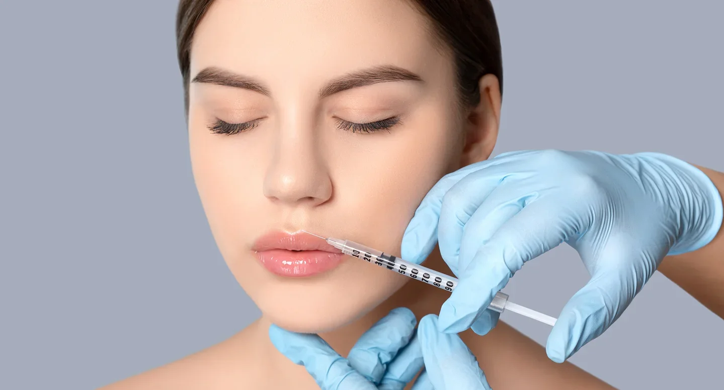 lip line filler