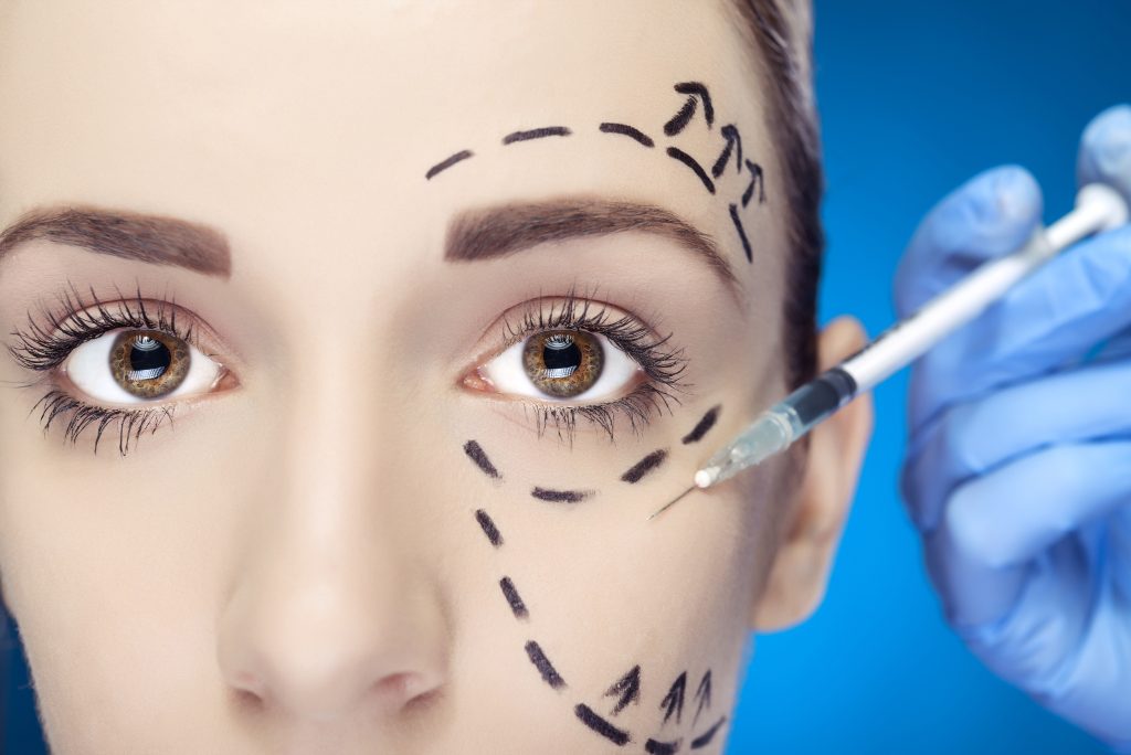 Liquid facelift: Close-up of woman with facial markings as clinician prepares injectable treatment.
