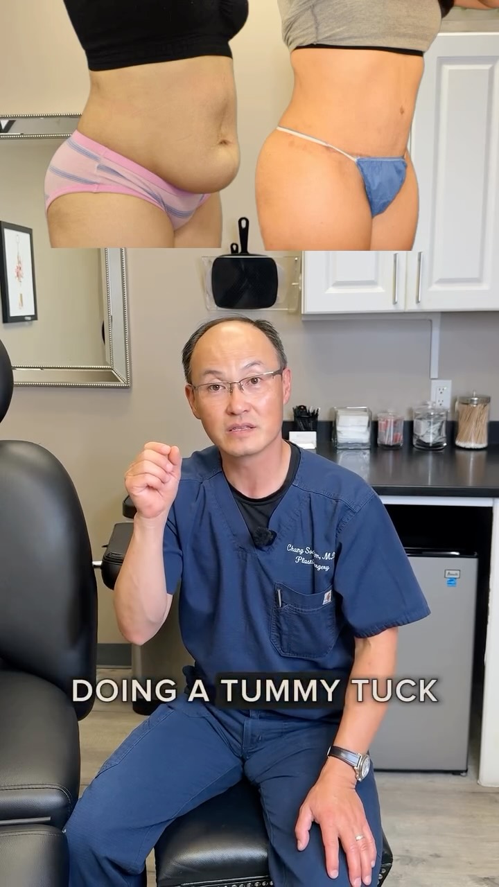 Tummy tuck with Dr. Kim